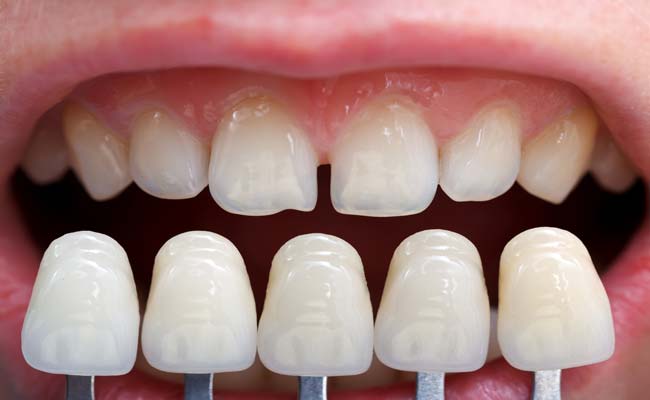 What Is An Orthodontist? What Is So Special About An Orthodontist?